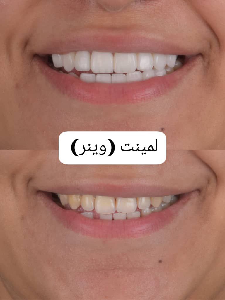 Image hover effect image